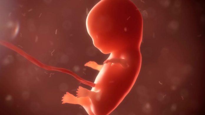 Aborto